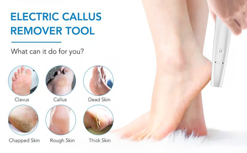 🔥Last Day Special Price £9.99!!💥-🎁Portable Electric Feet Callus Remover