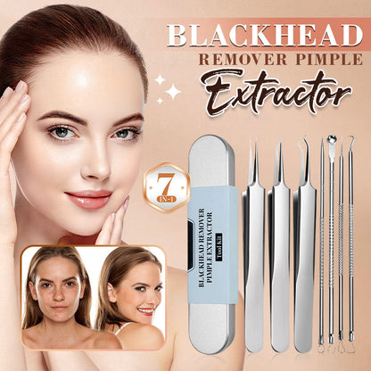 💓Hot sale💥Medical grade blackhead cell clip tool set