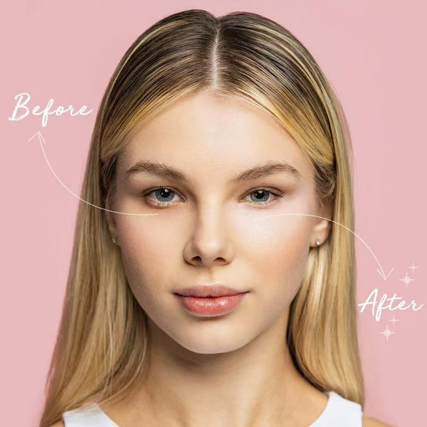 🏆 Last Day Special Price £9.99! 💐Buy 2 Get 1 Free🎁Under-Eye Brightener Cream – Dark Circle Correction & Fine Line Smoothing