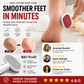 🥳HOT SALE🥳💞15K+ SOLD! Foot Scraper – From £4.99! Premium steel, dual surfaces & travel-ready. Smooth feet instantly – grab yours! ✅