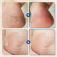 🔥 HOT SALE 🔥 Hydrating & Anti-Cracking Foot Cream – Intensive Moisture, Repairs Dry & Cracked Heels, Softens Rough Skin ✨