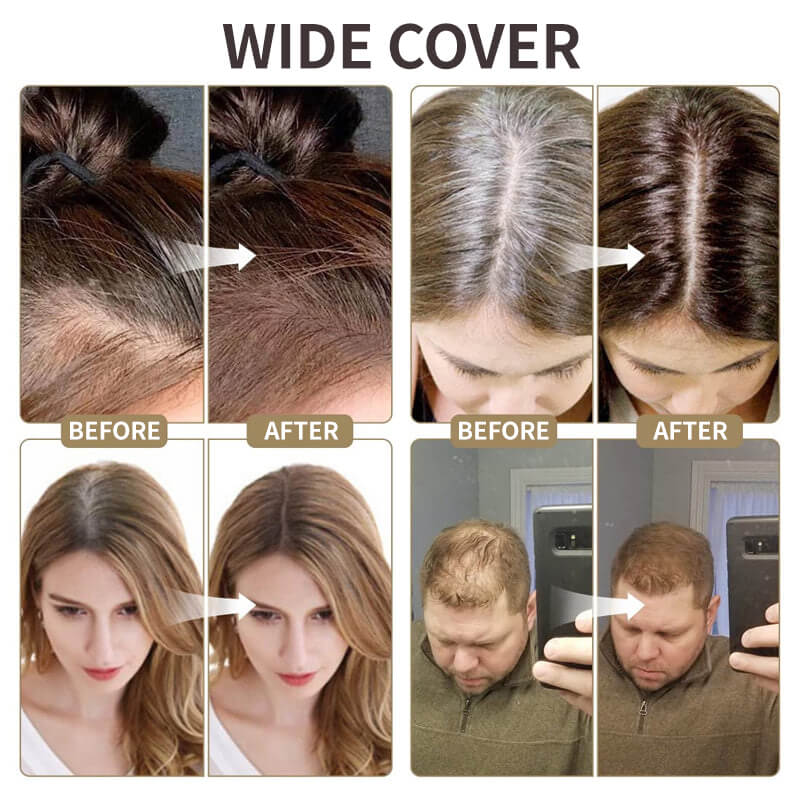 🥳2026 BESTSELLER🥾 Hairline Powder – 48-Hour Longevity, Clump-Free – Covers Roots, Gray Hair & Highlights – 12 Shades – Mirrored Travel Kit! 🛡️💨