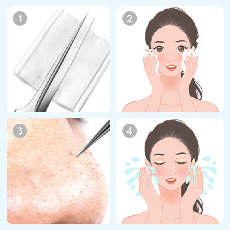 💓Hot sale💥Medical grade blackhead cell clip tool set