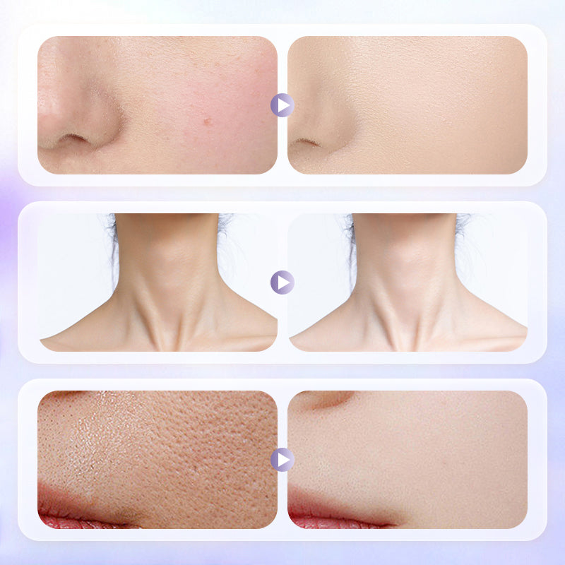 🔥 Limited offer – 40% off! 🎉 Lightweight, long-lasting face cream for luminous, radiant skin.