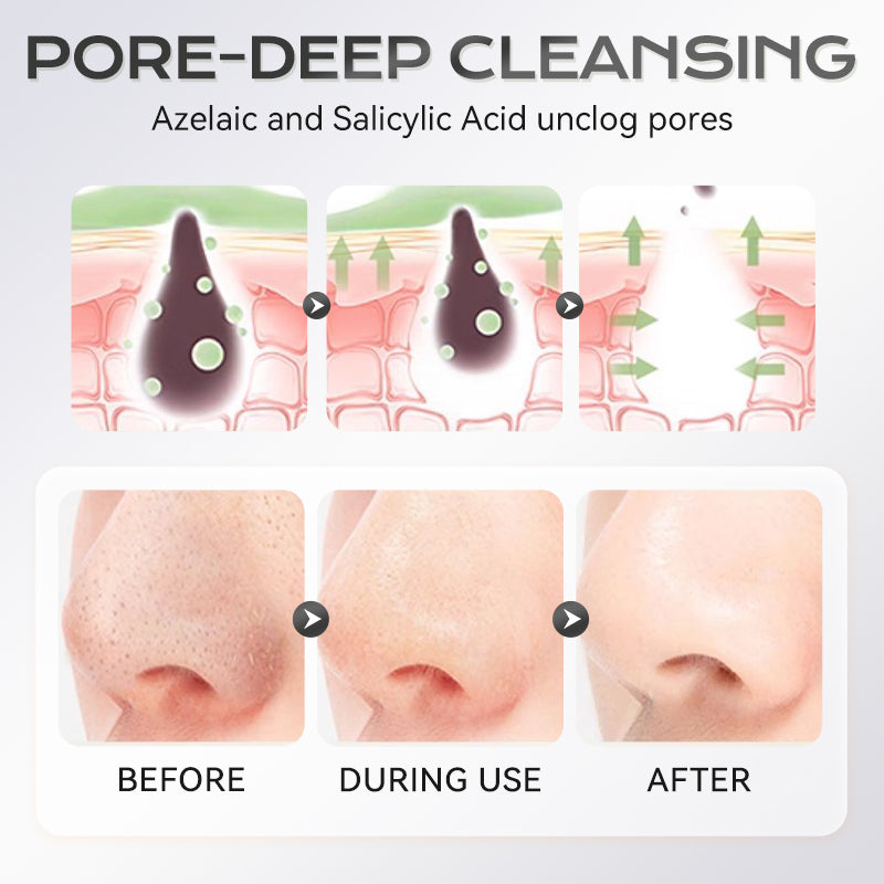 40g Azelaic Acid Clay Mask Stick