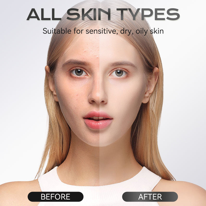 40g Azelaic Acid Clay Mask Stick