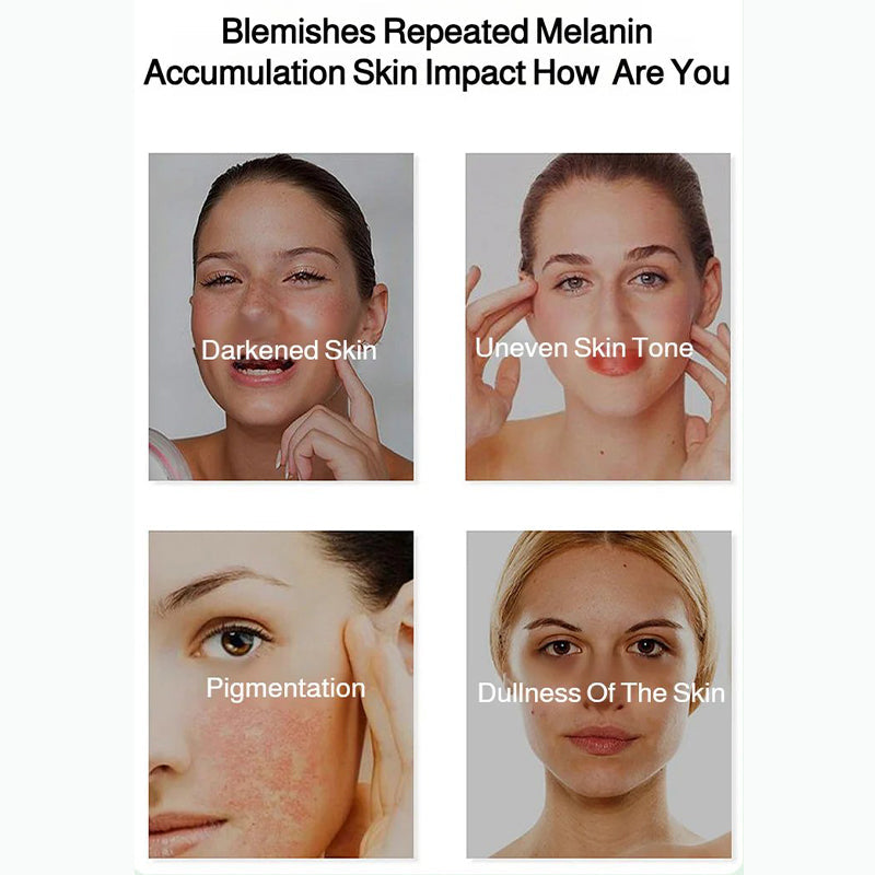 ✨ HOT SALE - BUY 2 GET 1 FREE! ✨ Radiant Skin & Spot Correcting Spray - Brightening Formula with Niacinamide for Even Tone & Glow 🌟🧴