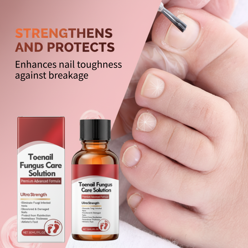 💅🌟 Nail Repair Essence – Strengthens and regenerates damaged nails in 7 days! ✨💪 Visible results, dermatologically tested. Your solution for strong, healthy nails.