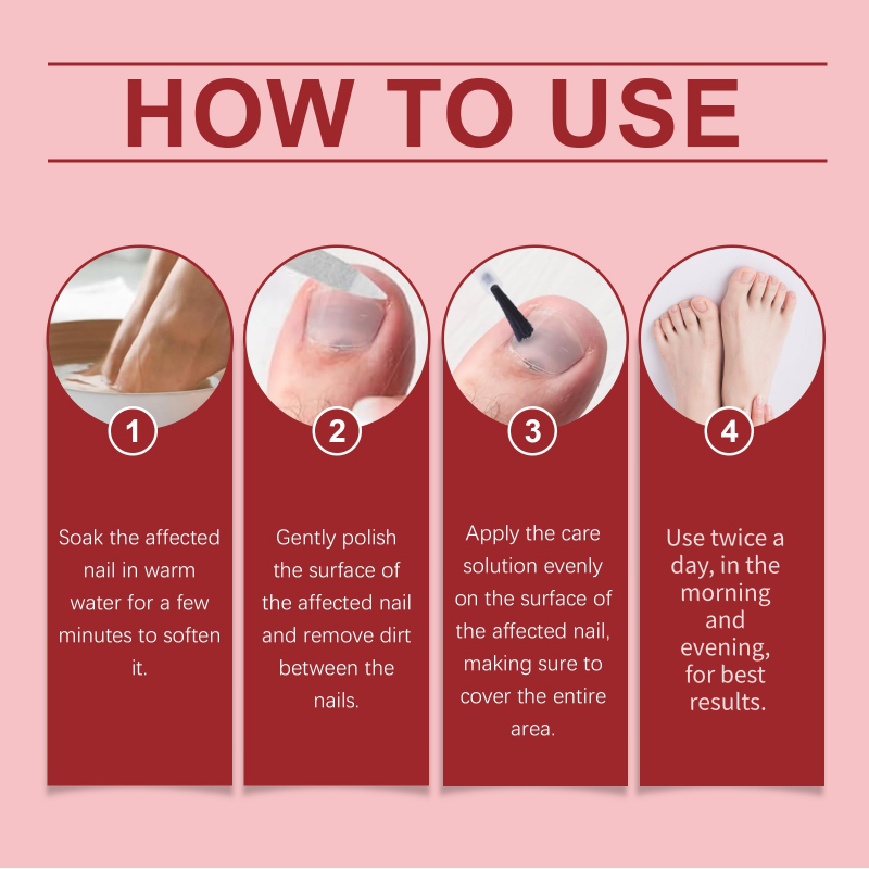 💅🌟 Nail Repair Essence – Strengthens and regenerates damaged nails in 7 days! ✨💪 Visible results, dermatologically tested. Your solution for strong, healthy nails.