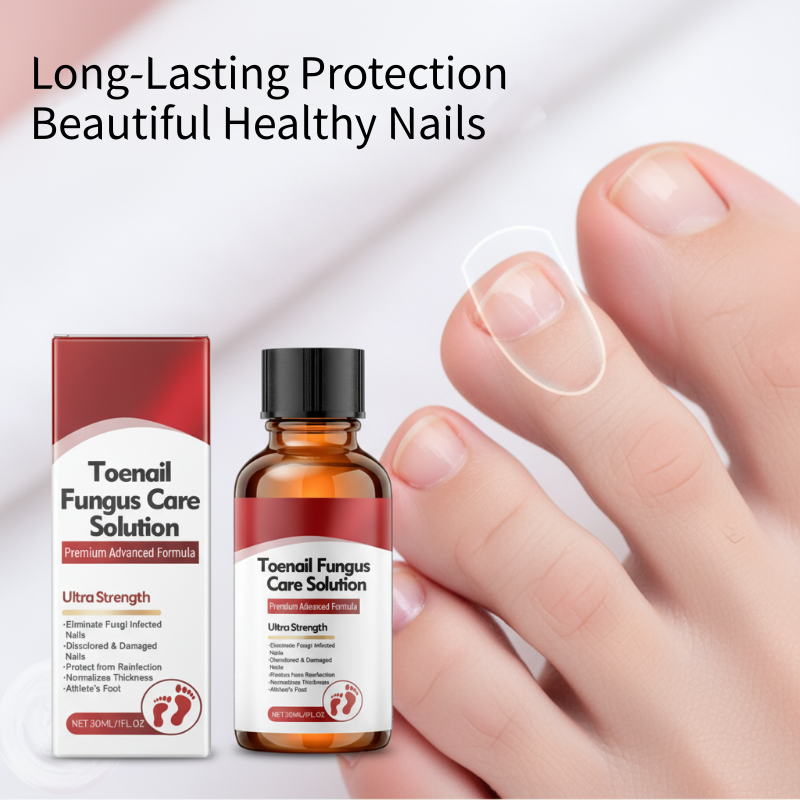 💅🌟 Nail Repair Essence – Strengthens and regenerates damaged nails in 7 days! ✨💪 Visible results, dermatologically tested. Your solution for strong, healthy nails.
