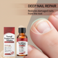 💅🌟 Nail Repair Essence – Strengthens and regenerates damaged nails in 7 days! ✨💪 Visible results, dermatologically tested. Your solution for strong, healthy nails.