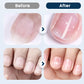 🔥2026 New Arrivals: 50% Off for a Limited Time!🔥Nourishing Nail Repair Spray