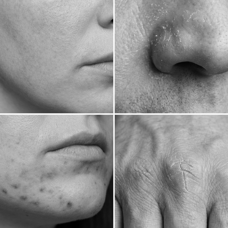 Multi-Effect Soothing Skin Repair Cream