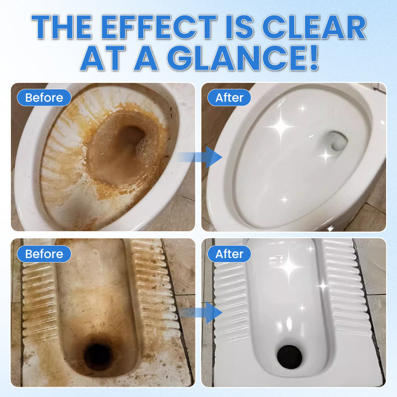 💖HOT SALE 49% OFF💖Toilet Active Oxygen Agent