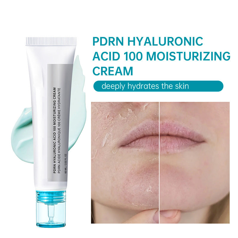 🥳2026 HOT SALE🥳💞50K+ SOLD!👸💧 50% OFF! PDRN Hyaluronic Cream – 10 types HA, +122% hydration. Clinical luxury, drop‑by‑drop. Youth in a tube! ✨👑