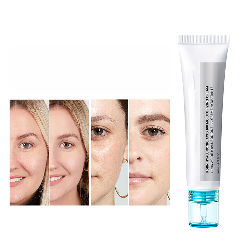 🥳2026 HOT SALE🥳💞50K+ SOLD!👸💧 50% OFF! PDRN Hyaluronic Cream – 10 types HA, +122% hydration. Clinical luxury, drop‑by‑drop. Youth in a tube! ✨👑