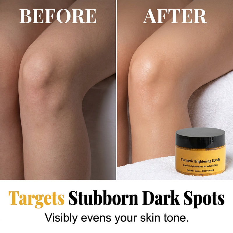 🥳 HOT SALE 2026 – 50% OFF! 💞 70,000+ SOLD! Turmeric Exfoliating Body Scrub