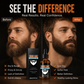 🔥2026 New Arrival🔥 Nourishing Beard Care Essential Oil 