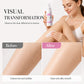 Gentle Hair Removal Mousse⏰50% OFF⏰ Gentle Hair Removal Mousse – Quick Results, Hydrating Formula, Fine Mousse Texture – Perfect for Body Care! 🛁