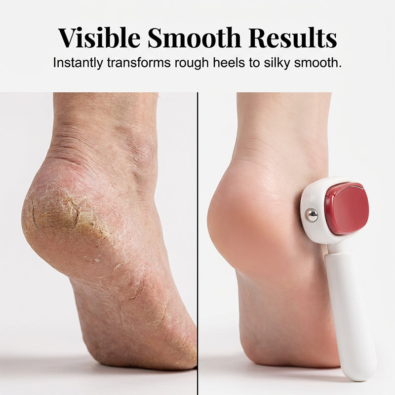 🎁Last Day Promotion 49% OFF🔥Double-Sided Foot Scraper for Callus Removal