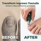 Wide-Jaw Toenail Clippers for Thick Nails