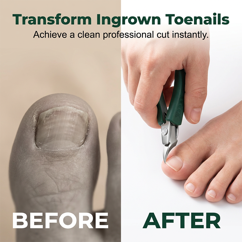 Wide-Jaw Toenail Clippers for Thick Nails