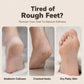 🥳HOT SALE🥳💞10K+ SOLD! Foot Remover – From £7.99! 3-in-1, nano glass & dual speed. Soft, smooth feet – grab yours! ✅