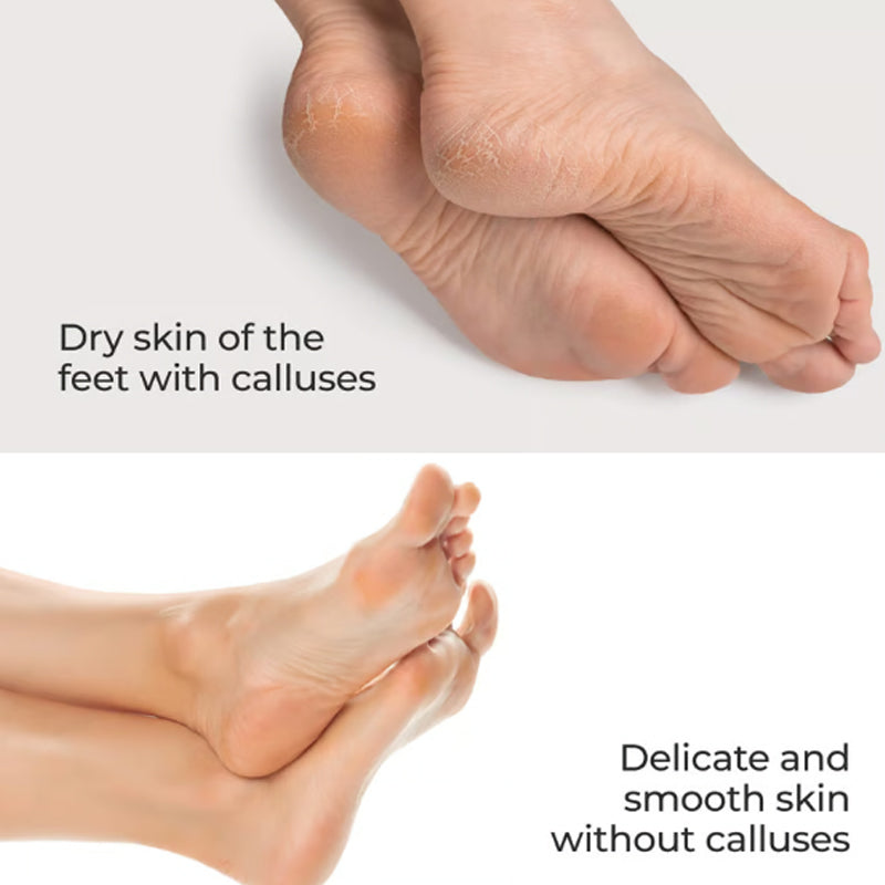 Exfoliating Nano Glass Plate with Case